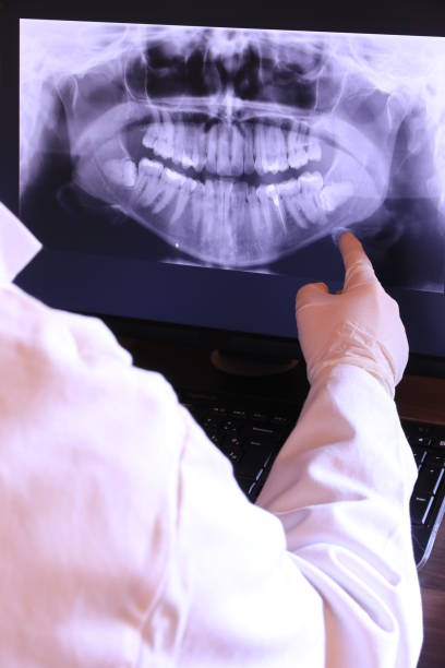 Best Dental Abscess Treatment in Statesboro, GA